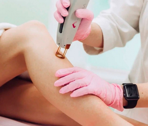 Скидка 50% на лазерную эпиляцию 